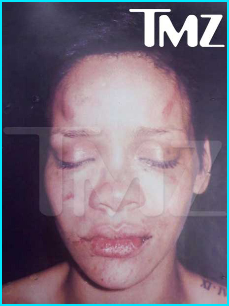 rihanna beat up 2011. Rihanna Smacked-Up By Chris