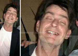 Toothless Charlie Sheen...coked-up out of his mind!!!