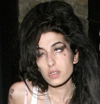 Amy Winehouse may want to go to rehab…NOW@!!!